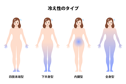 冷え性とは？